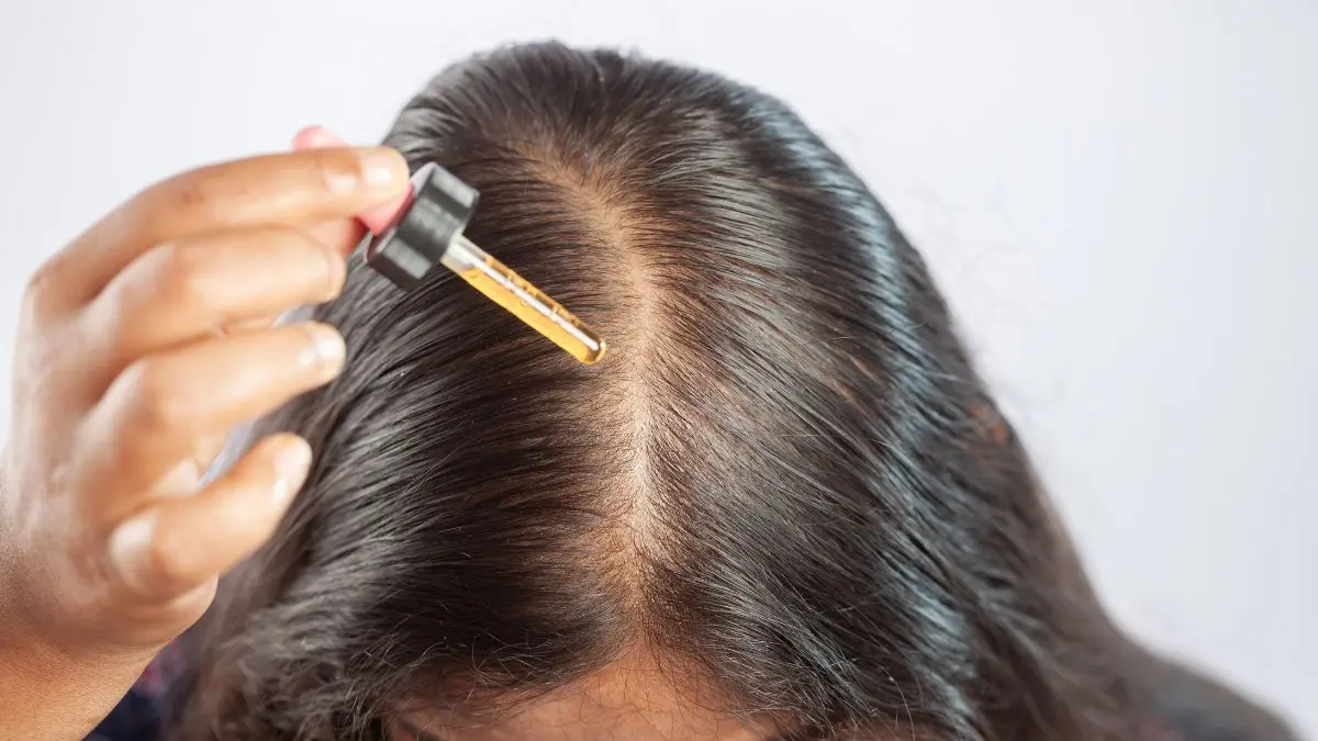 Minoxidil para mulheres: como esse aliado pode ajudar na queda de cabelo e falhas na sobrancelha